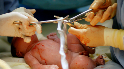 Five Care Tips for Your Newborn’s Umbilical Cord